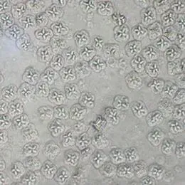 thumbnail for publication: Myxosporidiosis (Myxozoan Infections) in Warmwater Fish